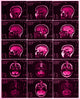 MRI of Normal Brain Fine Art Print by Science Source