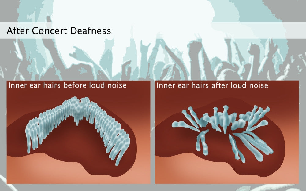 Noise-Induced Hearing Loss Fine Art Print by Gwen Shockey