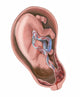 Pregnancy Complication: Placenta Previa Fine Art Print by TriFocal Communications