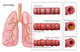 Bronchoconstriction Asthma Fine Art Print by Science Source
