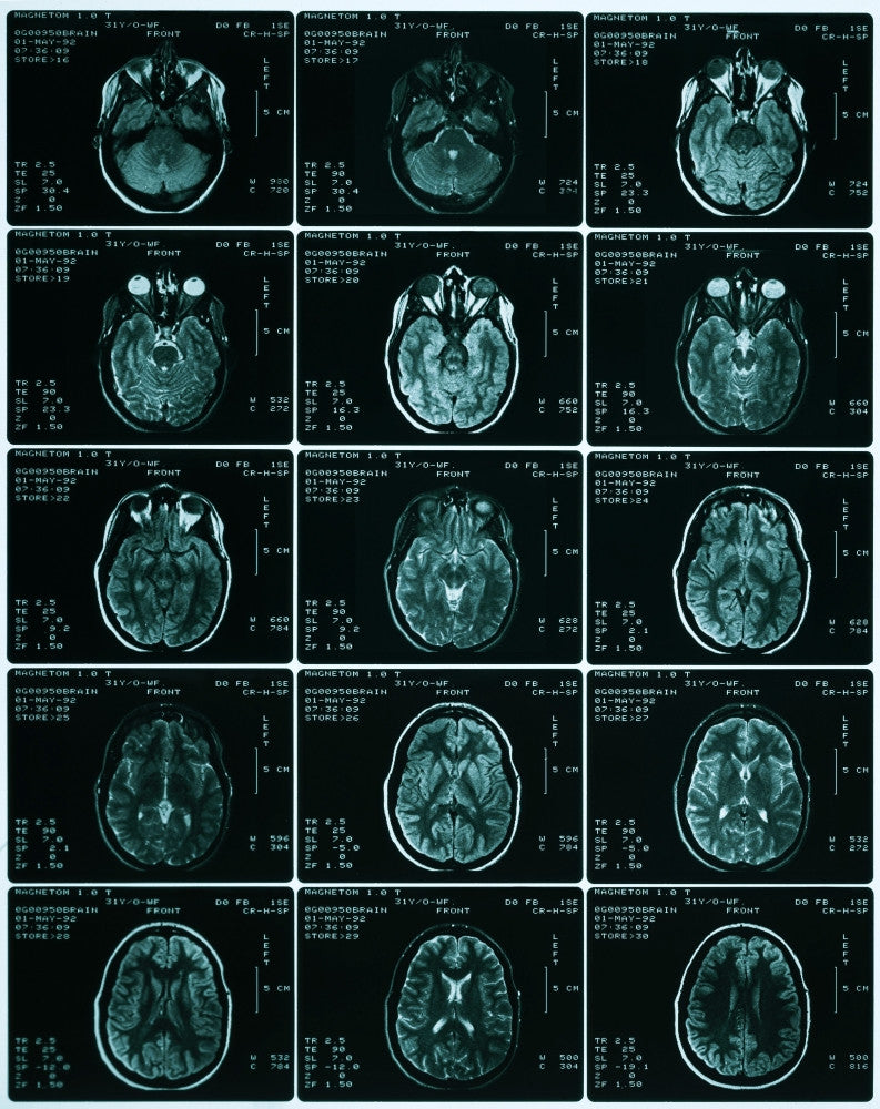 MRI of Normal Brain Fine Art Print by Science Source