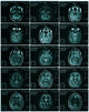 MRI of Normal Brain Fine Art Print by Science Source