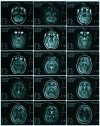 MRI of Normal Brain Fine Art Print by Science Source