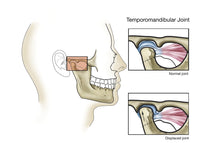 Temporomandibular Joint Anatomy Fine Art Print by TriFocal Communications