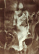 Raoul Ubac: The Nebula Fine Art Print by Granger Collection