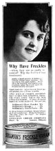 Stillman's Freckle Cream Vintage Advertisement Poster Print, 1919