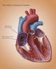 Heart's Electrical System Fine Art Print by Monica Schroeder