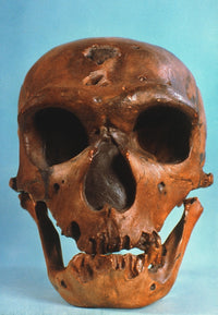 Neanderthal Skull Fine Art Print - Frontal View from La Chapelle-Aux-Saints