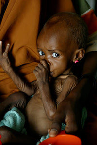 Malnourished Child in Clinic During 2008 Nigeria Famine Poster Print by VWPics