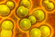 Microscopic View of Chlamydia Fine Art Print - Available in Multiple Sizes