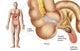 Medical Illustration of an Appendix with Appendicitis Fine Art Print