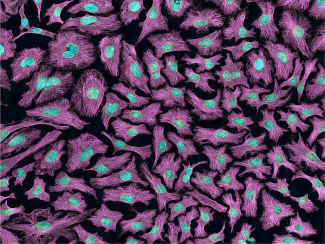 Multiphoton Fluorescence Image of HeLa Cells Fine Art Print by National Institutes of Health