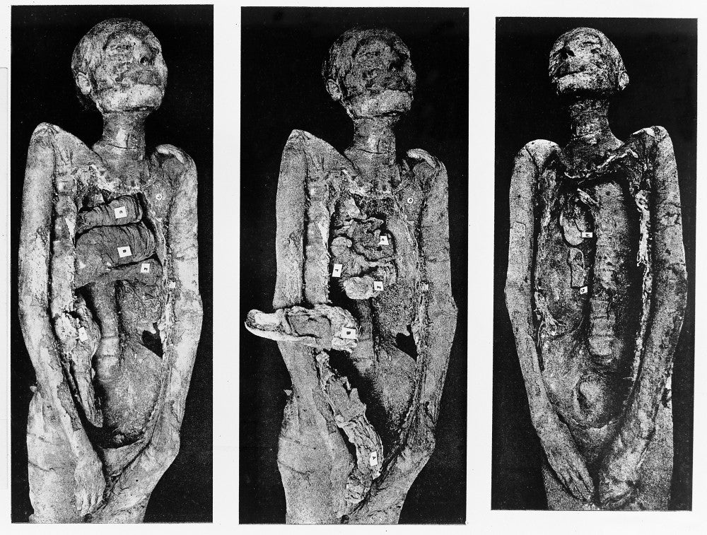 Processes of Mummification Fine Art Print by Science Source