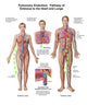 Pulmonary Embolism Pathway Fine Art Print - Embolus to Heart & Lungs