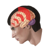 Football Concussion Fine Art Print by Spencer Sutton | Science Source