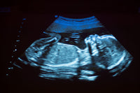 Ultrasound of a 20 Week Pregnancy Fine Art Print by VWPics