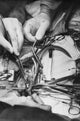Close-Up of Surgeons Performing Open-Heart Surgery Fine Art Print