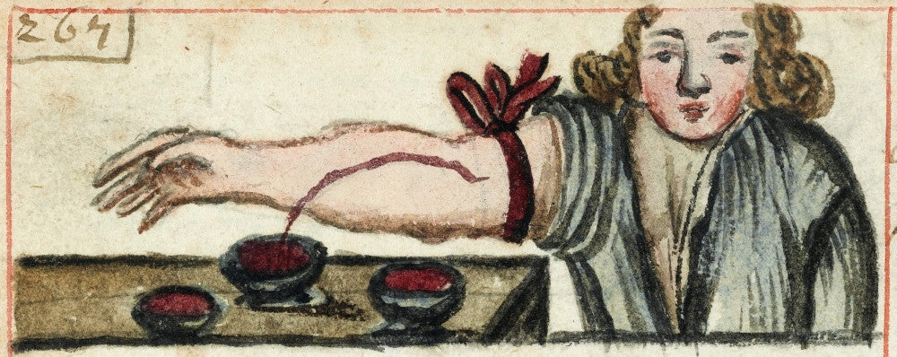 Bloodletting Illustration Fine Art Print by Science Source