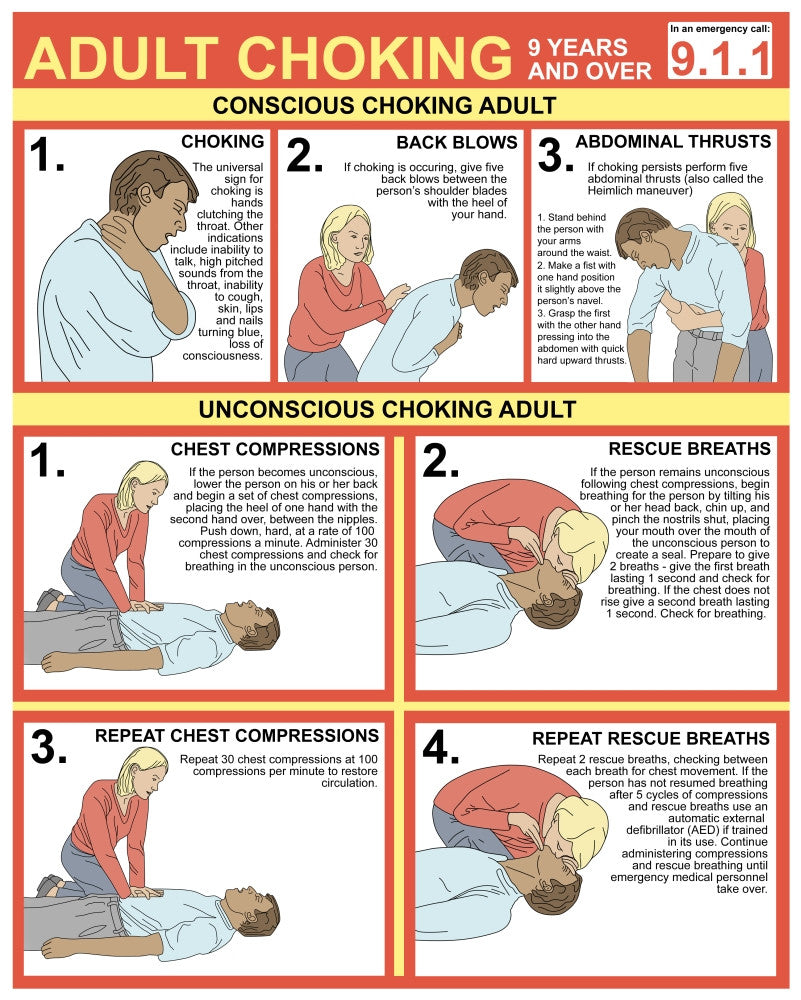 Choking First Aid Chart Fine Art Print by Gwen Shockey