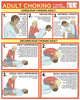 Choking First Aid Chart Fine Art Print by Gwen Shockey