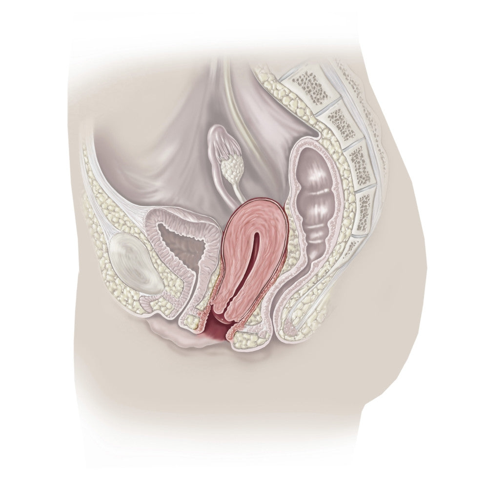 Sagittal Section of Pelvis with Prolapsed Uterus Fine Art Print by TriFocal Communications