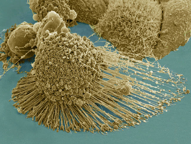 Scanning Electron Micrograph of an Apoptotic HeLa Cell Fine Art Print by National Institutes of Health