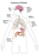 Symptoms of Diabetes Educational Poster Print by Science Source