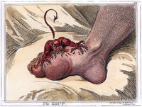 Gout Etching Artwork by James Gillray - Fine Art Print