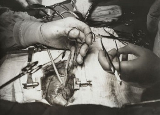 Close-Up of Surgeon’s Hands Performing Open-Heart Surgery Fine Art Print