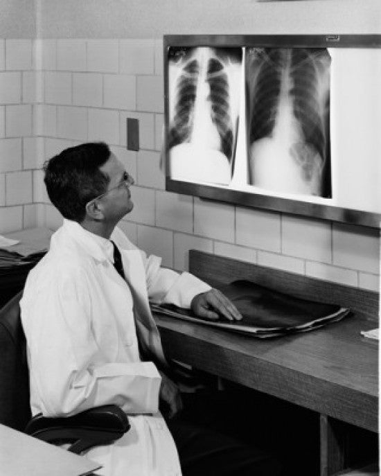 Doctor Analyzing X-Ray Images of Lungs Fine Art Print