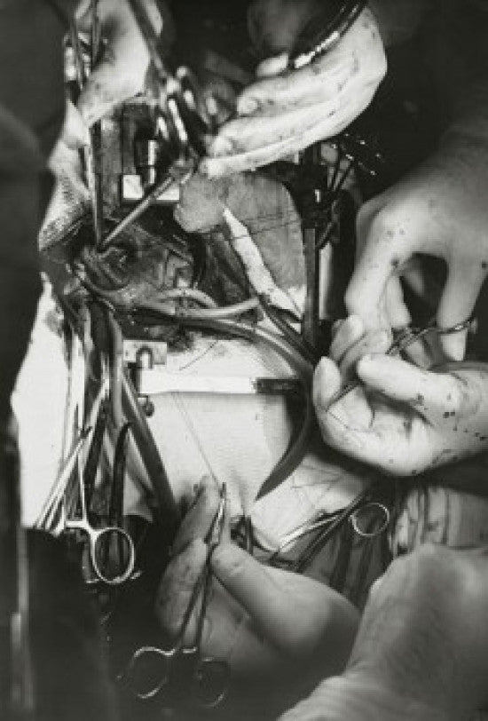 Close-up of Surgeon’s Hands Performing Open-Heart Surgery Poster Print