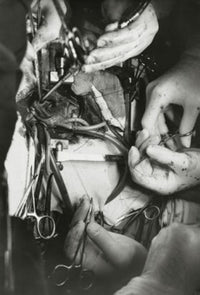 Close-up of Surgeon’s Hands Performing Open-Heart Surgery Poster Print