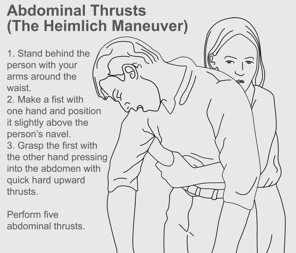 Heimlich Maneuver Educational Poster Print by Gwen Shockey