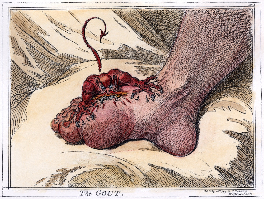 Gout Etching Artwork by James Gillray - Fine Art Print