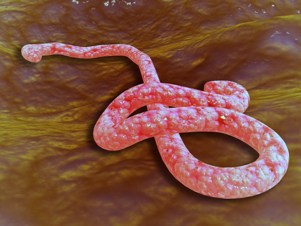 Microscopic View of Ebola Virus Fine Art Print - StockTrek Images
