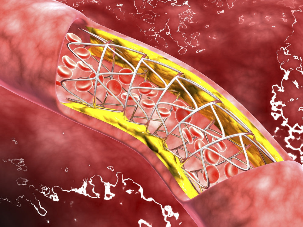 Microscopic Artery Cross-Section Fine Art Print - Blood Flow & Stent Deployment