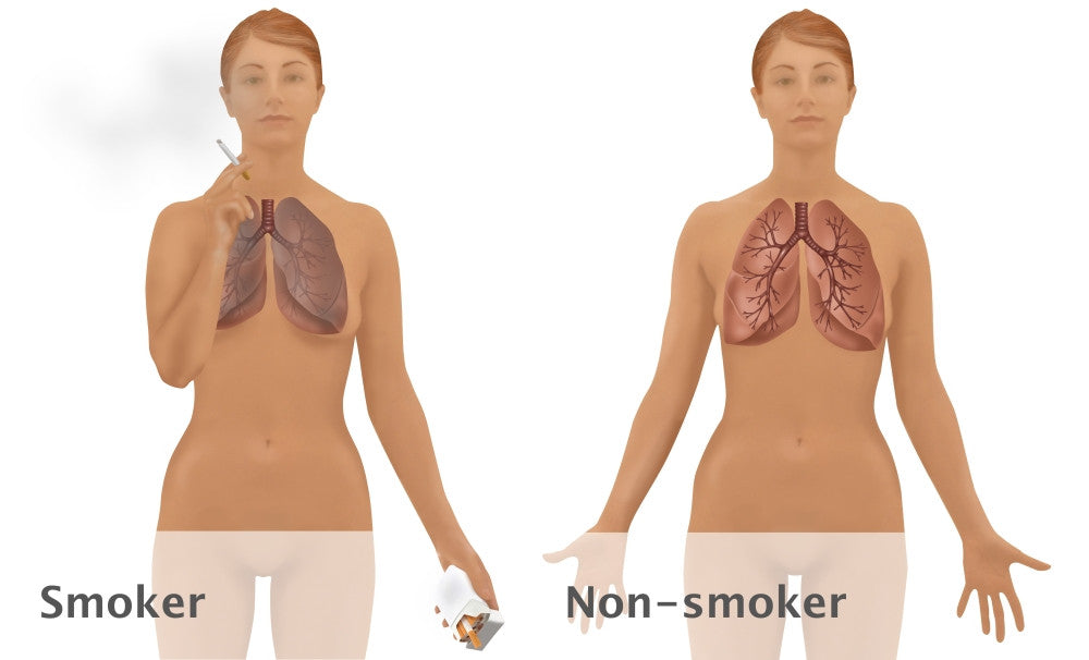Lungs of Smoker vs. Non-Smoker Fine Art Print by Gwen Shockey