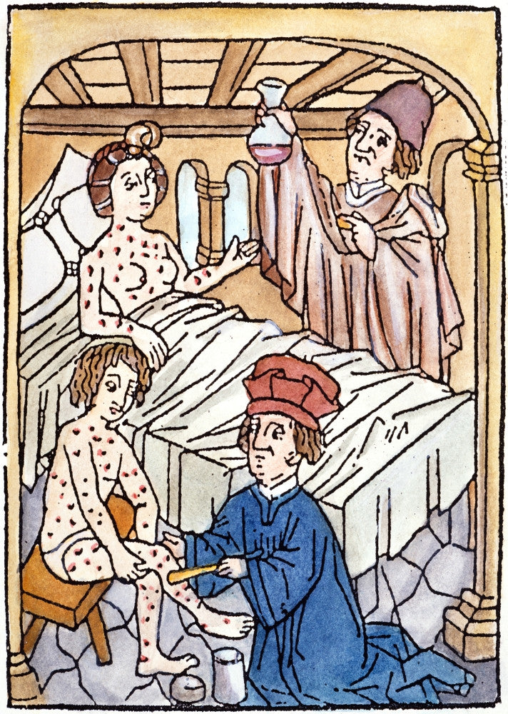 Medieval Syphilis Woodcut Art Print, 1497 by Granger Collection