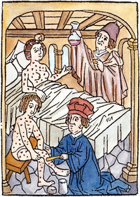 Medieval Syphilis Woodcut Art Print, 1497 by Granger Collection