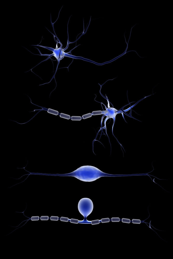 Conceptual Neuron Fine Art Print - Perfect for Home or Office