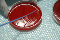 Staphylococcus Bacteria Fine Art Print from Human Skin by NIH/Stocktrek Images