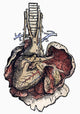 Human Heart Woodcut Art Print from Vesalius' De Humani Corporis Fabrica
