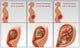 Three Trimesters Fine Art Print by Gwen Shockey | Science Source