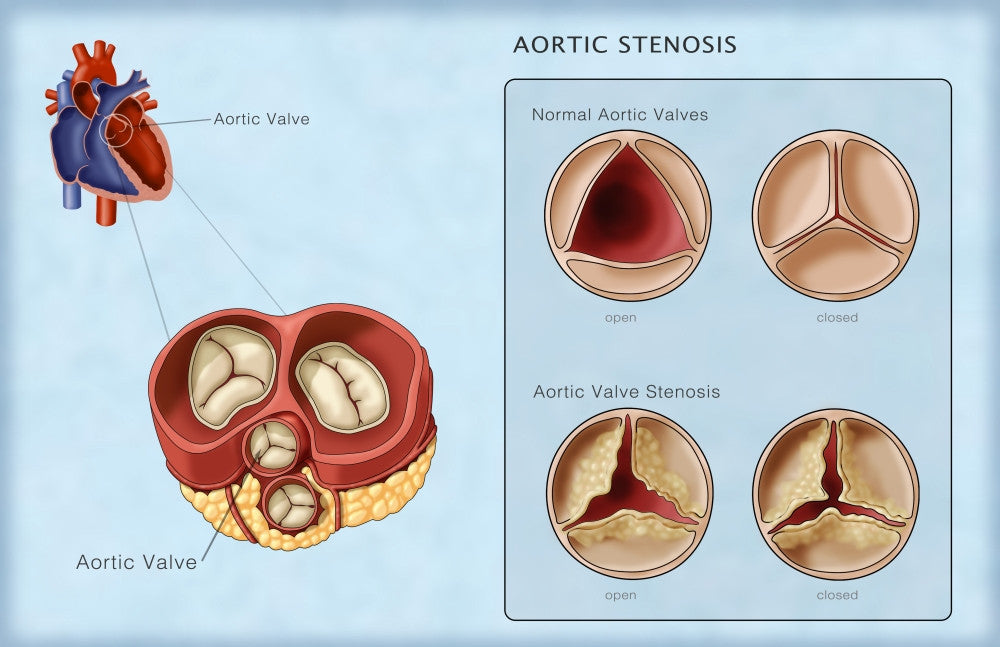 Aortic Valves Illustration Poster Print by Monica Schroeder